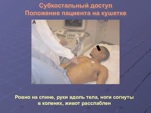 Субкостальный доступ Положение пациента на кушетке Ровно на спине, руки