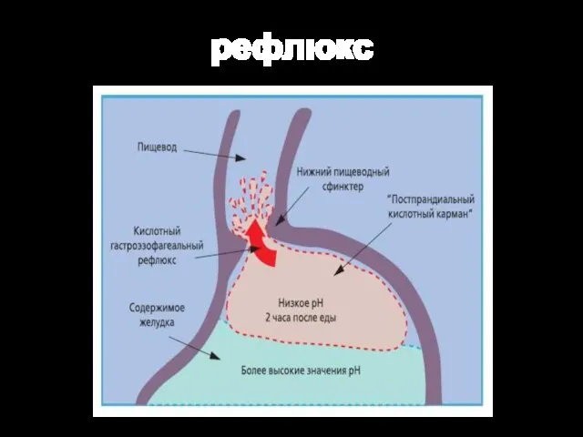 рефлюкс