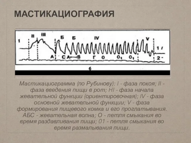 МАСТИКАЦИОГРАФИЯ Мастикациограмма (по Рубинову): I - фаза покоя; II -