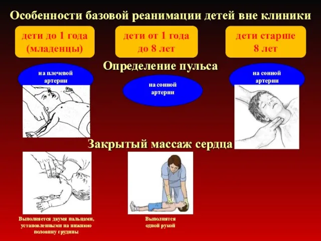 Особенности базовой реанимации детей вне клиники Определение пульса дети до