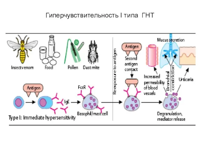 Гиперчувствительность I типа ГНТ