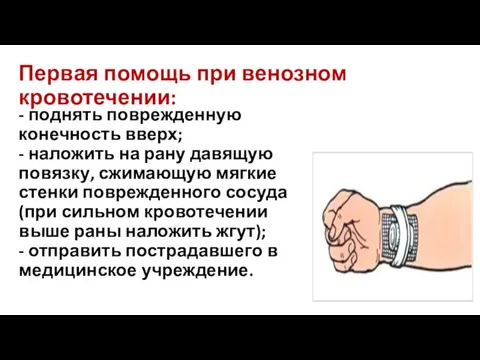 Первая помощь при венозном кровотечении: - поднять поврежденную конечность вверх;