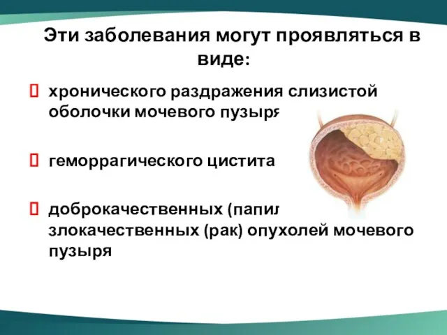 Эти заболевания могут проявляться в виде: хронического раздражения слизистой оболочки мочевого пузыря геморрагического