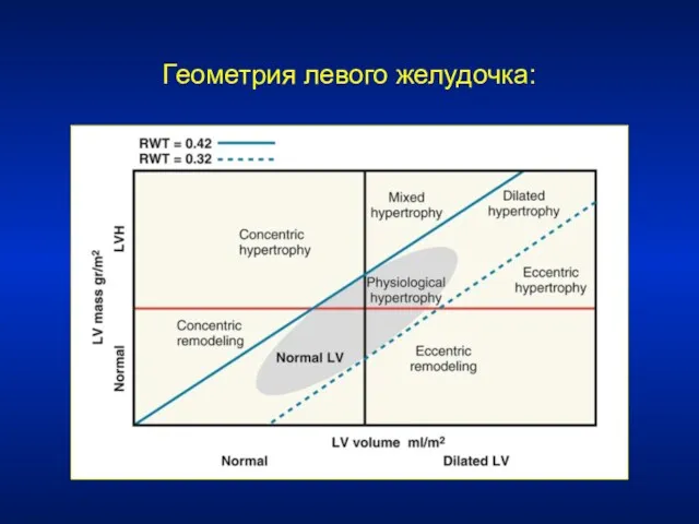 Геометрия левого желудочка: