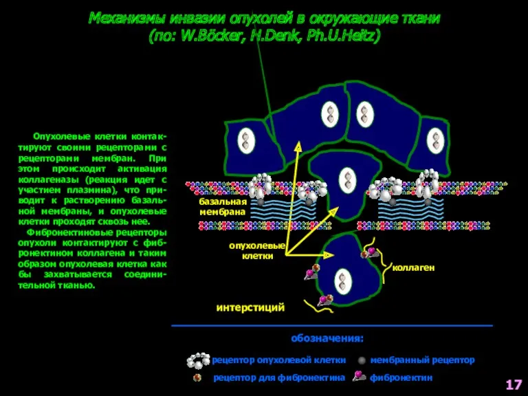 Механизмы инвазии опухолей в окружающие ткани (по: W.Böcker, H.Denk, Ph.U.Heitz)