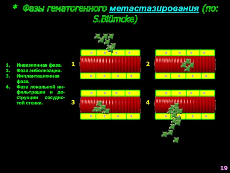 * Фазы гематогенного метастазирования (по: S.Blümcke) Инвазионная фаза. Фаза эмболизации.