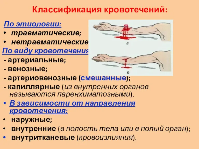 Классификация кровотечений: По этиологии: травматические; нетравматические. По виду кровотечения: -