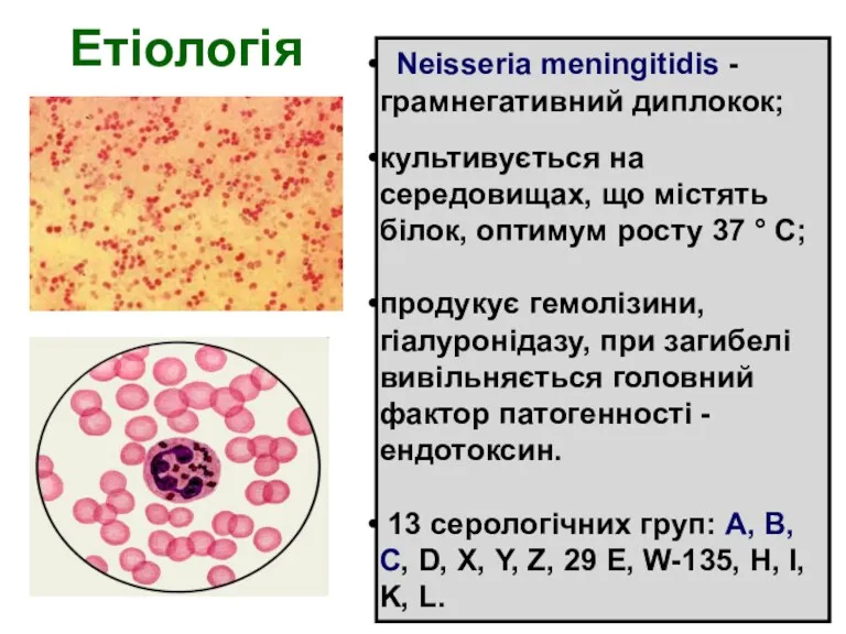 Етіологія Neisseria meningitidis -грамнегативний диплокок; культивується на середовищах, що містять білок, оптимум росту