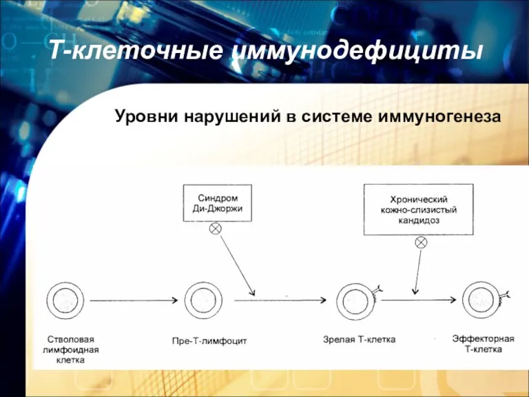 Т-клеточные иммунодефициты Уровни нарушений в системе иммуногенеза