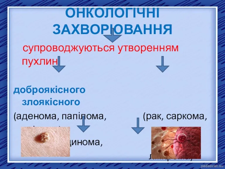 ОНКОЛОГІЧНІ ЗАХВОРЮВАННЯ супроводжуються утворенням пухлин доброякісного злоякісного (аденома, папілома, (рак, саркома, ліпома) аденокарцинома, лімфома) характеру