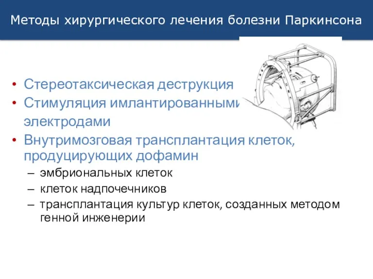 Методы хирургического лечения болезни Паркинсона Стереотаксическая деструкция Стимуляция имлантированными электродами