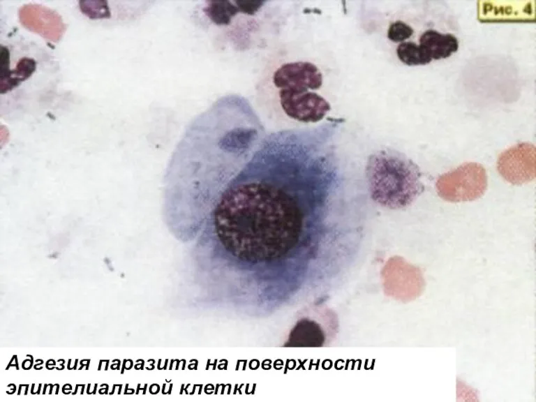 Адгезия паразита на поверхности эпителиальной клетки