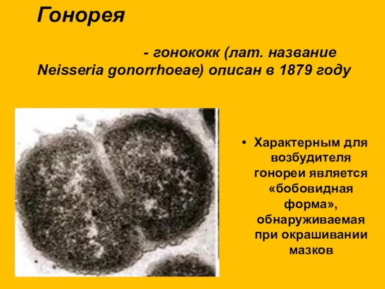 Гонорея Возбудитель - гонококк (лат. название Neisseria gonorrhoeae) описан в