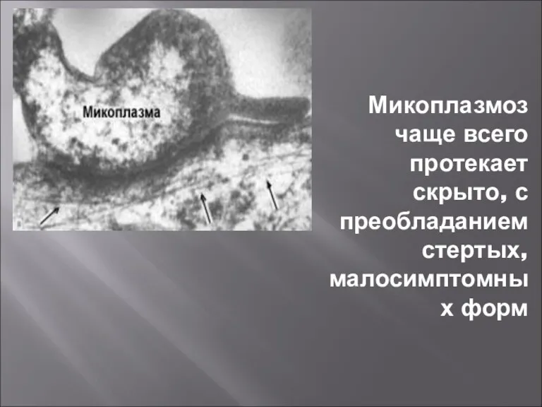 Микоплазмоз чаще всего протекает скрыто, с преобладанием стертых, малосимптомных форм