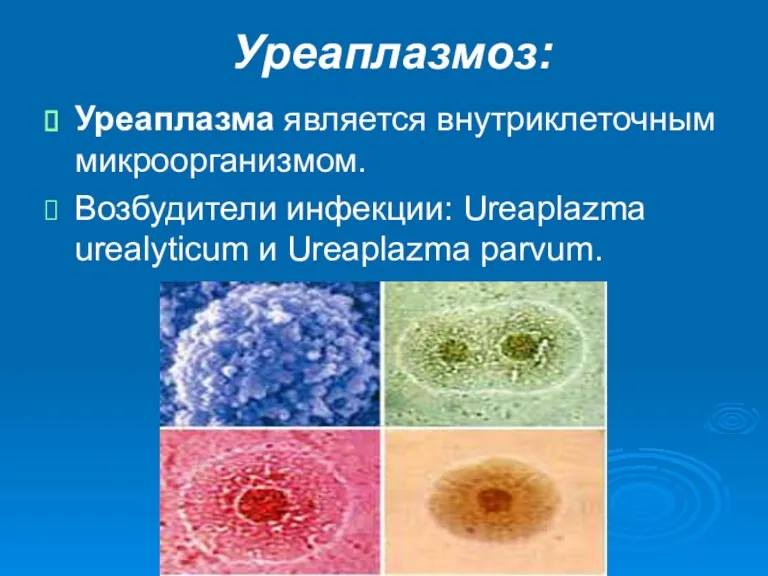 Уреаплазмоз: Уреаплазма является внутриклеточным микроорганизмом. Возбудители инфекции: Ureaplazma urealyticum и Ureaplazma parvum.