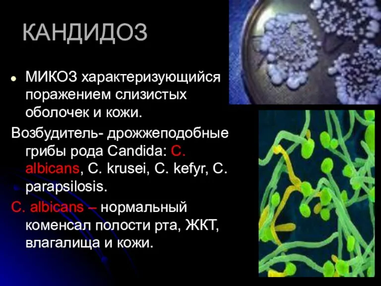 КАНДИДОЗ МИКОЗ характеризующийся поражением слизистых оболочек и кожи. Возбудитель- дрожжеподобные