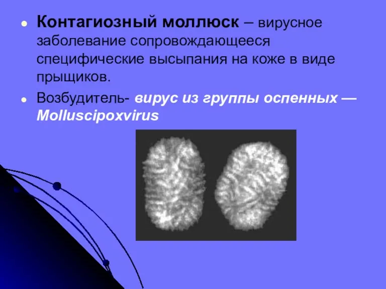 Контагиозный моллюск – вирусное заболевание сопровождающееся специфические высыпания на коже