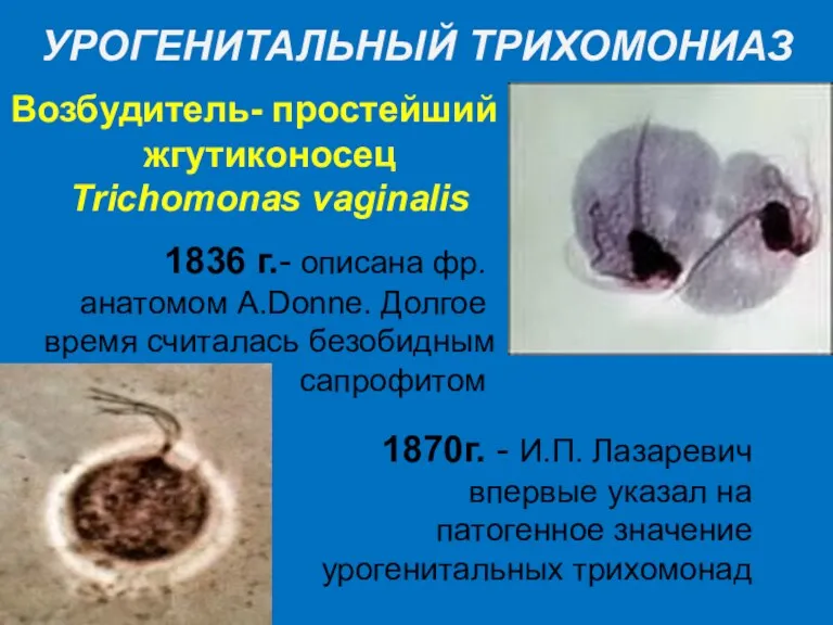 УРОГЕНИТАЛЬНЫЙ ТРИХОМОНИАЗ Возбудитель- простейший жгутиконосец Trichomonas vaginalis 1836 г.- описана