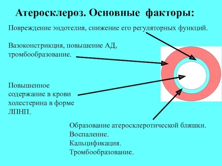 Атеросклероз. Основные факторы: Повреждение эндотелия, снижение его регуляторных функций. Вазоконстрикция,