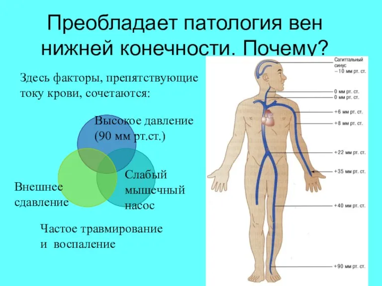 Преобладает патология вен нижней конечности. Почему? Здесь факторы, препятствующие току