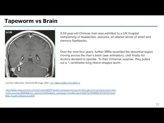 Tapeworm vs Brain Journal reference: Genome Biology, DOI: 10.1186/s13059-014-0510-3 http://www.newscientist.com/article/dn26597-watch-a-tapeworm-squirm-through-a-living-mans-brain.html?utm_source=NSNS&utm_medium=SOC&utm_campaign=hoot&cmpid=SOC%7CNSNS%7C2014-GLOBAL-hoot#.VG9qGvmsVH4