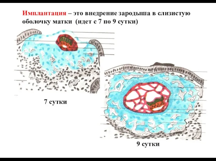 Имплантация – это внедрение зародыша в слизистую оболочку матки (идет