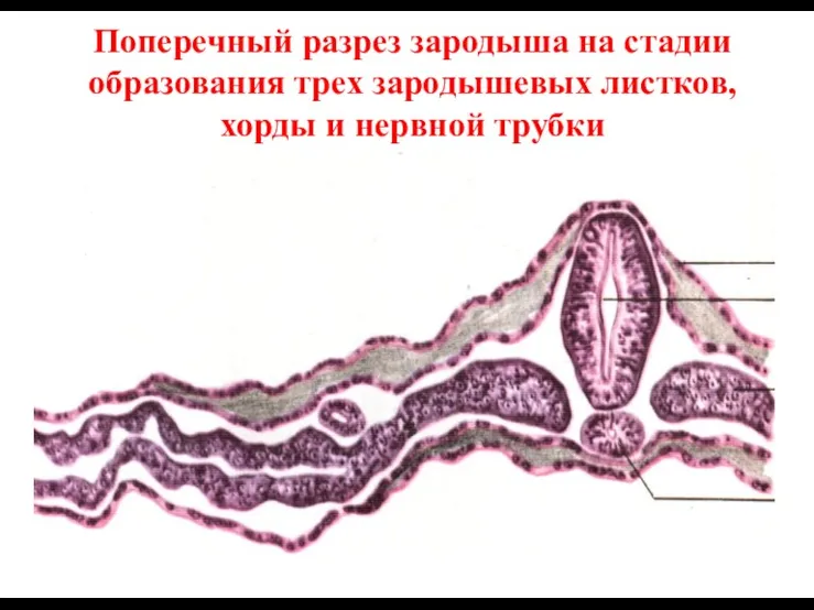 Поперечный разрез зародыша на стадии образования трех зародышевых листков, хорды и нервной трубки