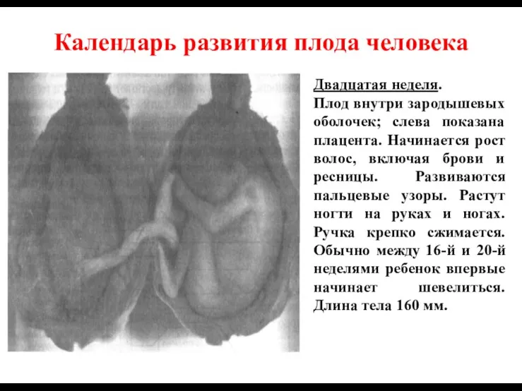 Календарь развития плода человека Двадцатая неделя. Плод внутри зародышевых оболочек; слева показана плацента.