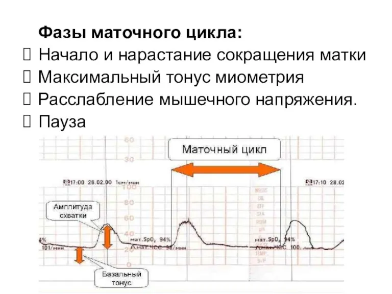 Фазы маточного цикла: Начало и нарастание сокращения матки Максимальный тонус миометрия Расслабление мышечного напряжения. Пауза