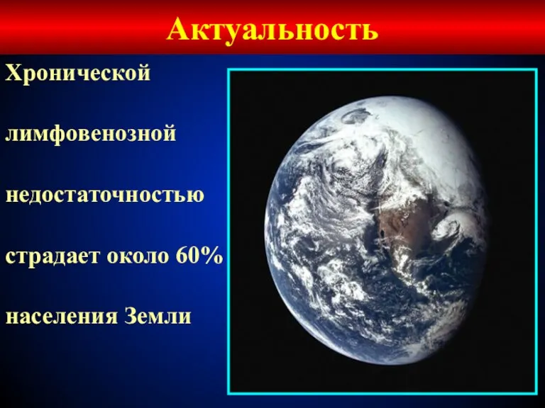 Актуальность Хронической лимфовенозной недостаточностью страдает около 60% населения Земли