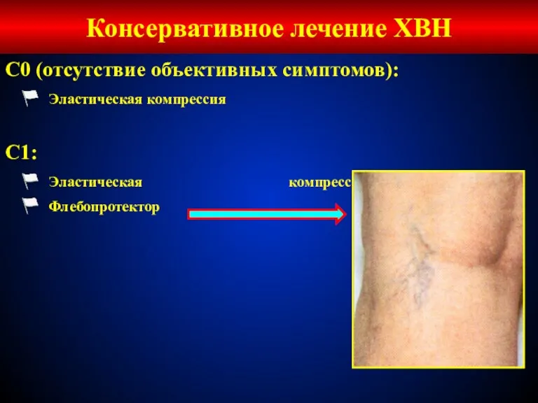 Консервативное лечение ХВН С0 (отсутствие объективных симптомов): Эластическая компрессия С1: Эластическая компрессия Флебопротектор