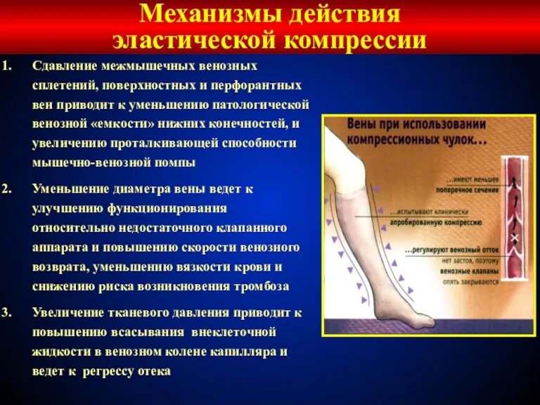 Сдавление межмышечных венозных сплетений, поверхностных и перфорантных вен приводит к