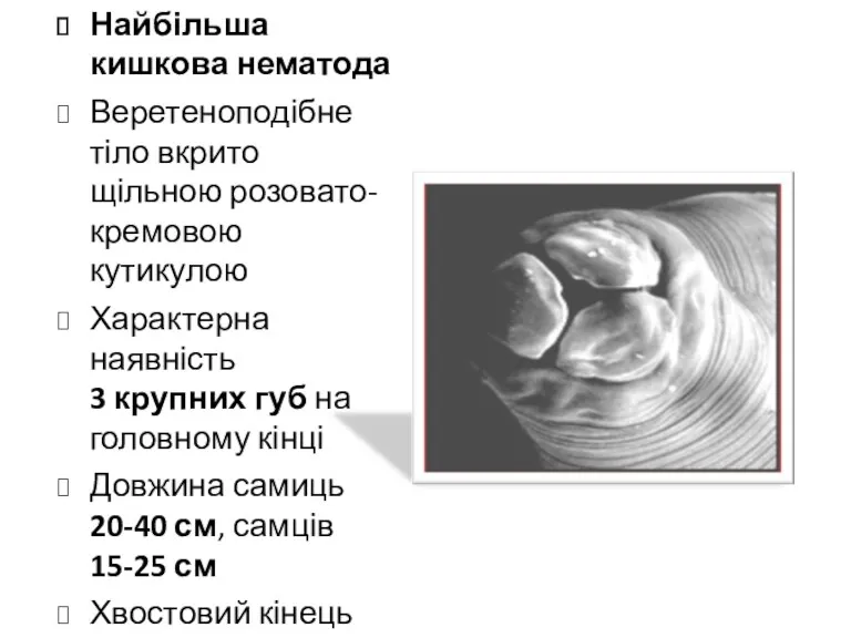 Найбільша кишкова нематода Веретеноподібне тіло вкрито щільною розовато-кремовою кутикулою Характерна наявність 3 крупних