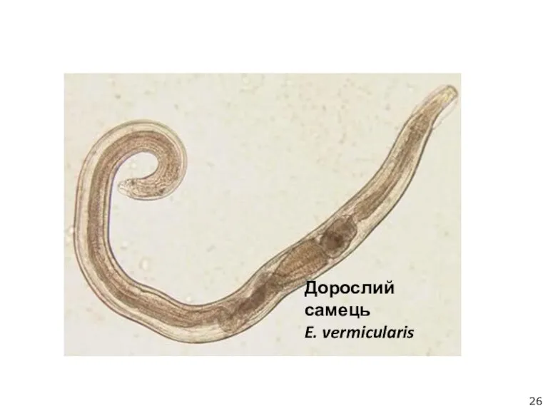 Дорослий самець E. vermicularis