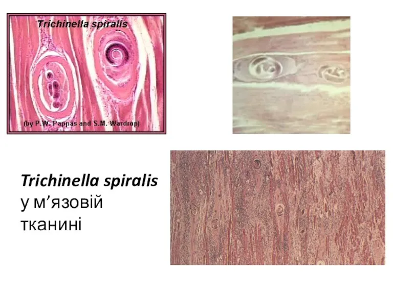 Trichinella spiralis у м’язовій тканині