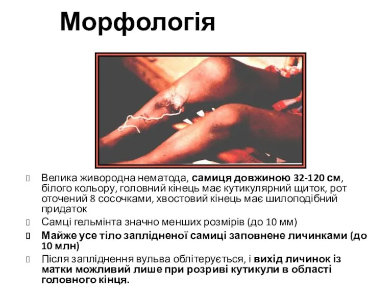 Морфологія Велика живородна нематода, самиця довжиною 32-120 см, білого кольору,