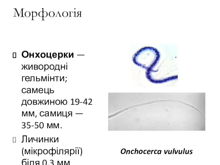 Морфологія Онхоцерки — живородні гельмінти; самець довжиною 19-42 мм, самиця
