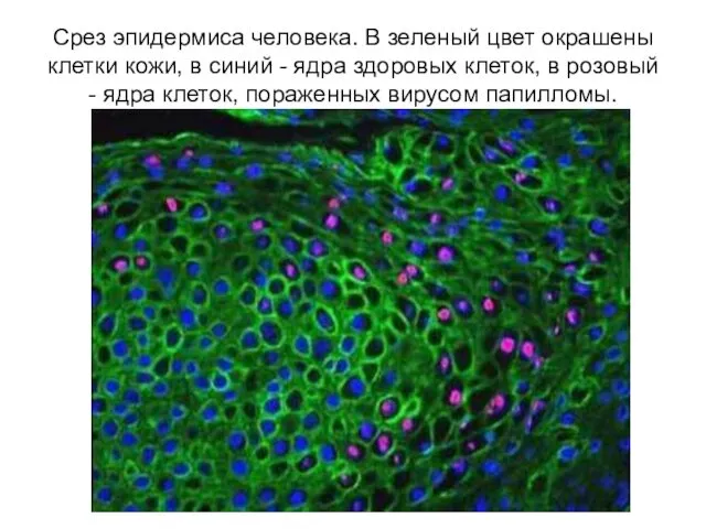 Срез эпидермиса человека. В зеленый цвет окрашены клетки кожи, в