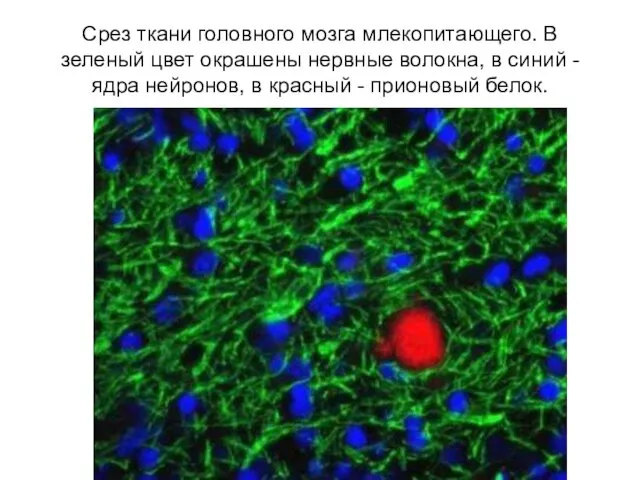 Срез ткани головного мозга млекопитающего. В зеленый цвет окрашены нервные