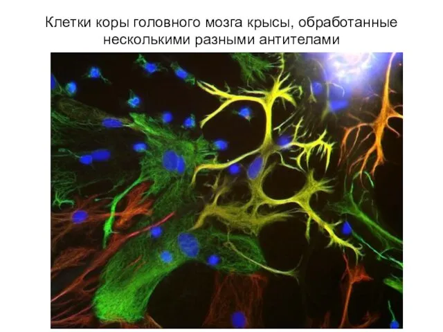 Клетки коры головного мозга крысы, обработанные несколькими разными антителами