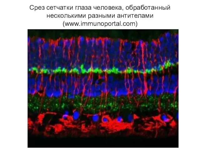 Срез сетчатки глаза человека, обработанный несколькими разными антителами (www.immunoportal.com)