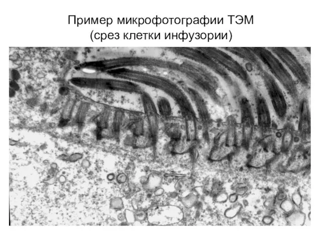 Пример микрофотографии ТЭМ (срез клетки инфузории)