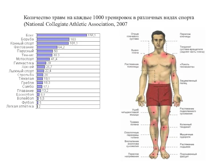 Количество травм на каждые 1000 тренировок в различных видах спорта (National Collegiate Athletic Association, 2007