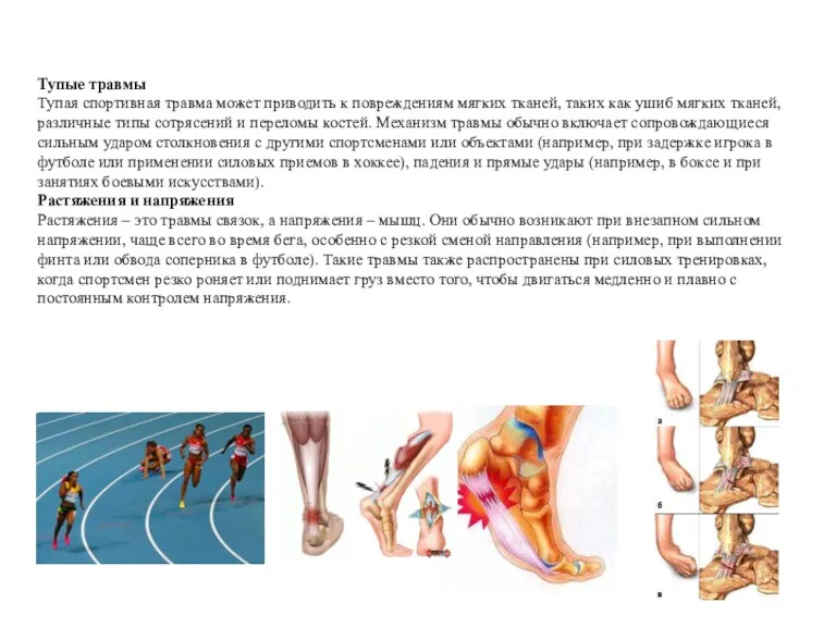 Тупые травмы Тупая спортивная травма может приводить к повреждениям мягких
