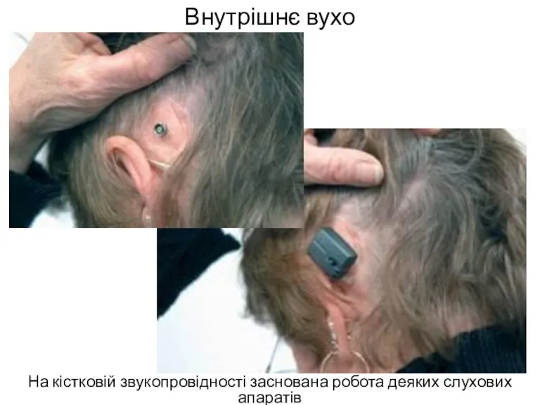 Внутрішнє вухо На кістковій звукопровідності заснована робота деяких слухових апаратів