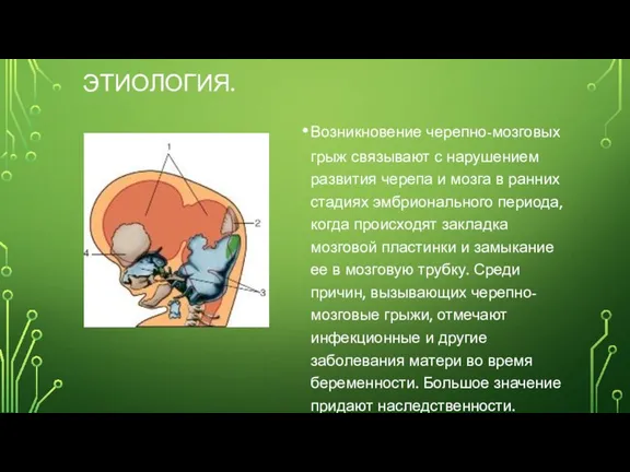 ЭТИОЛОГИЯ. Возникновение черепно-мозговых грыж связывают с нарушением развития черепа и мозга в ранних