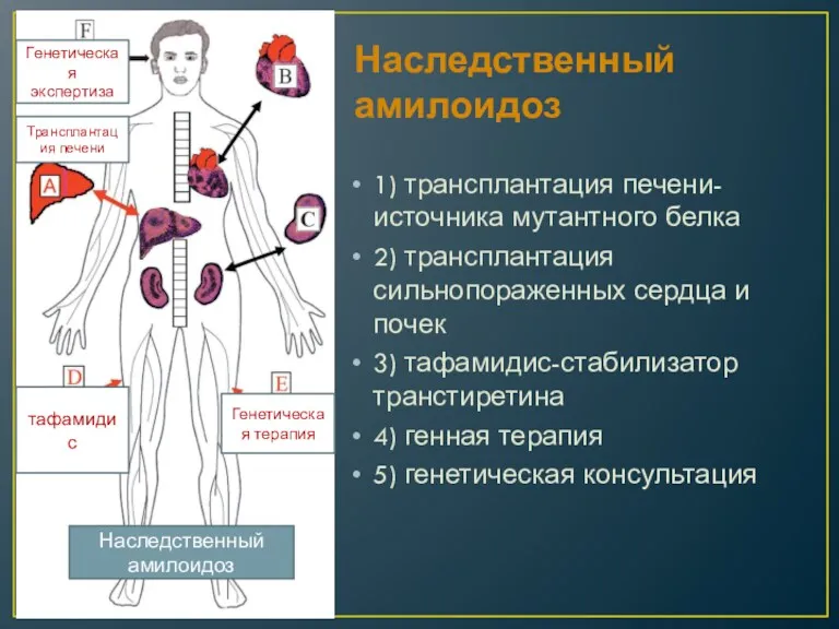 Наследственный амилоидоз 1) трансплантация печени- источника мутантного белка 2) трансплантация