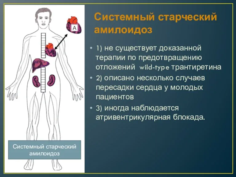 Системный старческий амилоидоз 1) не существует доказанной терапии по предотвращению