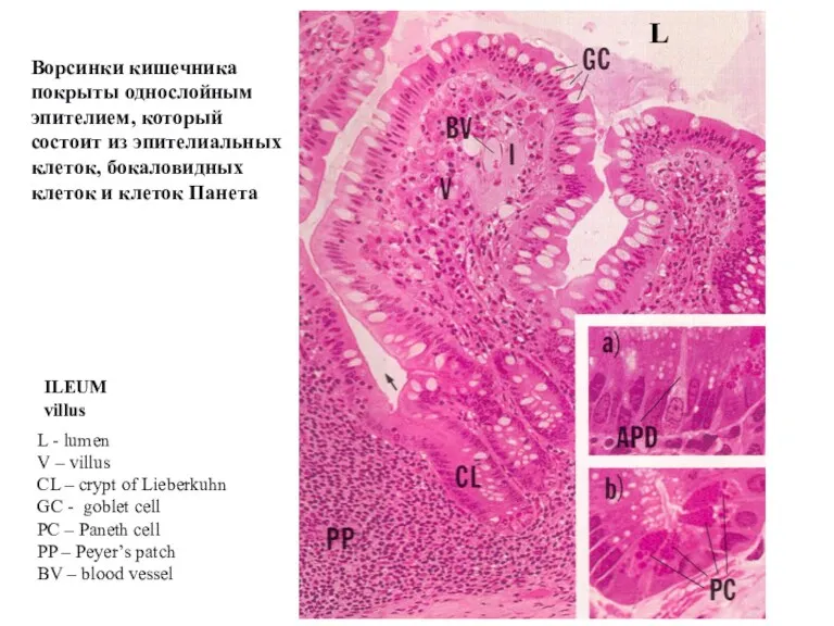 ILEUM villus L - lumen V – villus CL –