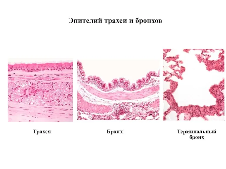 Эпителий трахеи и бронхов Трахея Бронх Терминальный бронх